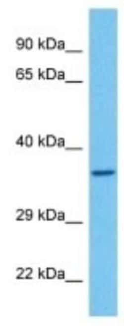 Olfactory receptor 474 Rabbit anti-Mouse, Polyclonal, Novus Biologicals 100 &mu;g | Buy Online | Novus Biologicals | Fisher Scientific